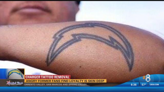 Charger fans with tattoo regret can get removal at 